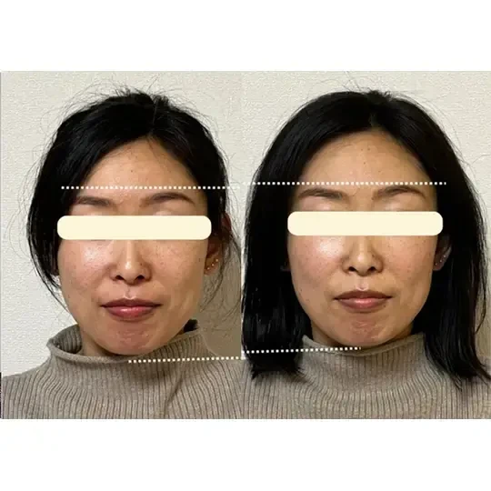 ⑫