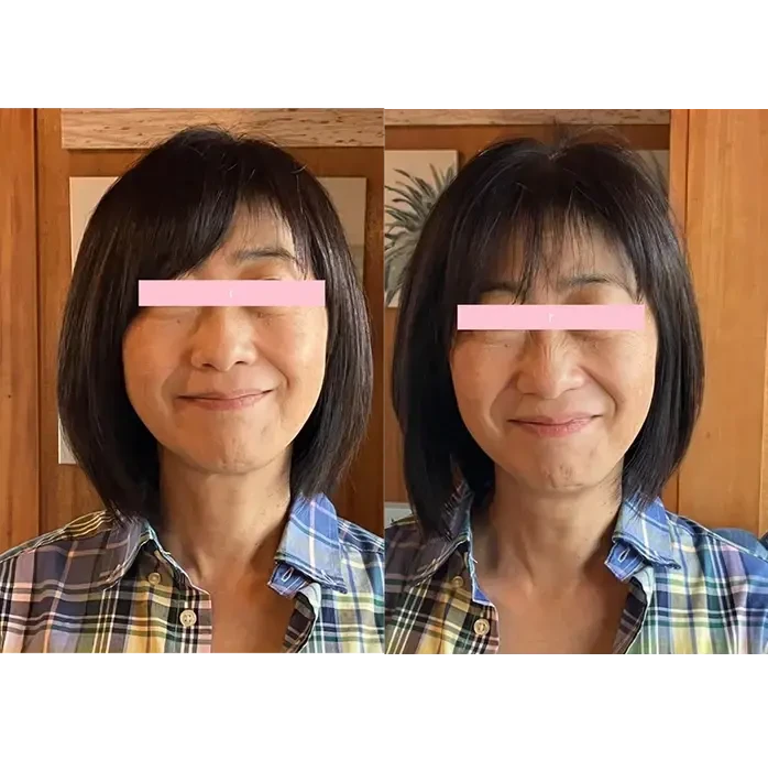 ③