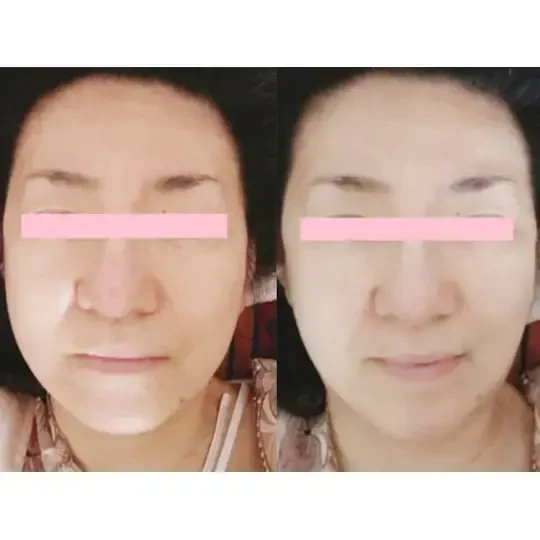 ⑭