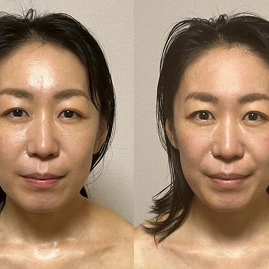 画像1517：心身の不調回復でお顔もスッキリ変化